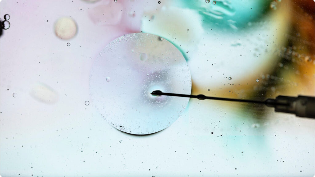 Chuyển phôi là bước quan trọng trong thụ tinh trong ống nghiệm