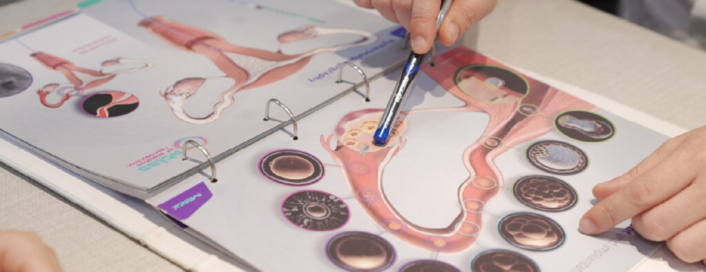 Hiểu lầm về IUI: Luôn thành công trong lần đầu tiên