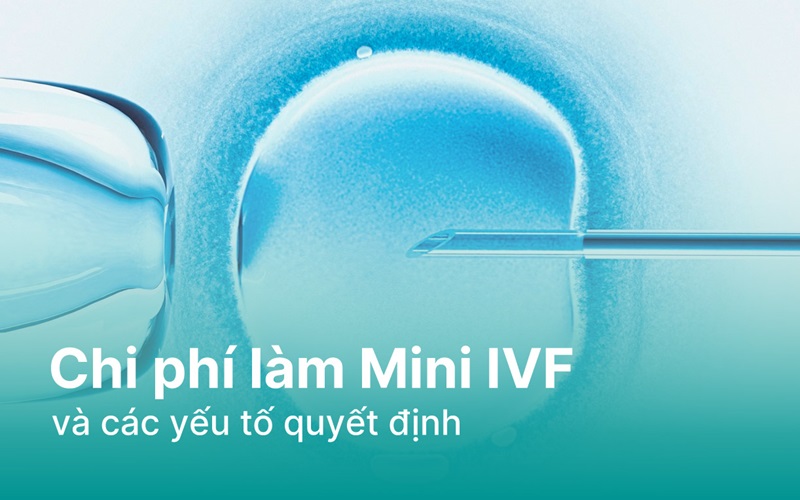 Chi phí làm Mini IVF