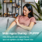 mẩn ngứa thai kỳ