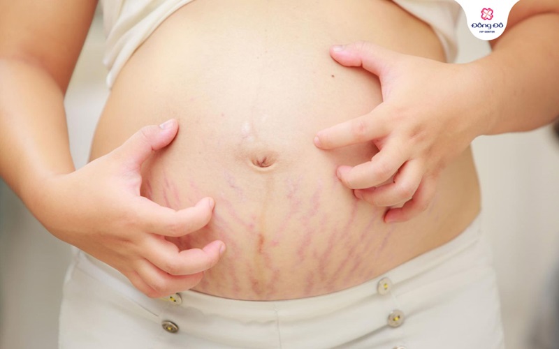 Kinh nghiệm điều trị PUPPP từ bác sĩ Tăng Đức Cương