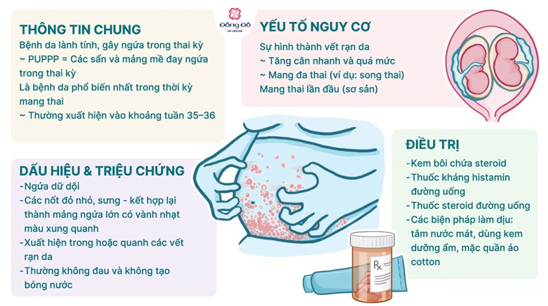 Các phương pháp điều trị PUPPP hiệu quả