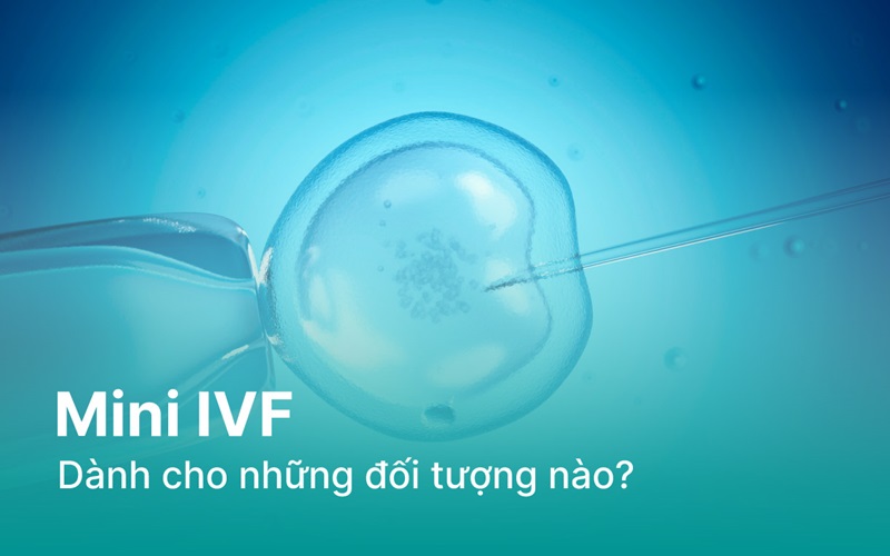 Đối tượng nên chọn Mini IVF