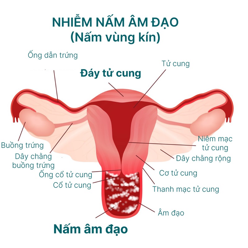 Phòng ngừa và giữ gìn sức khỏe vùng kín