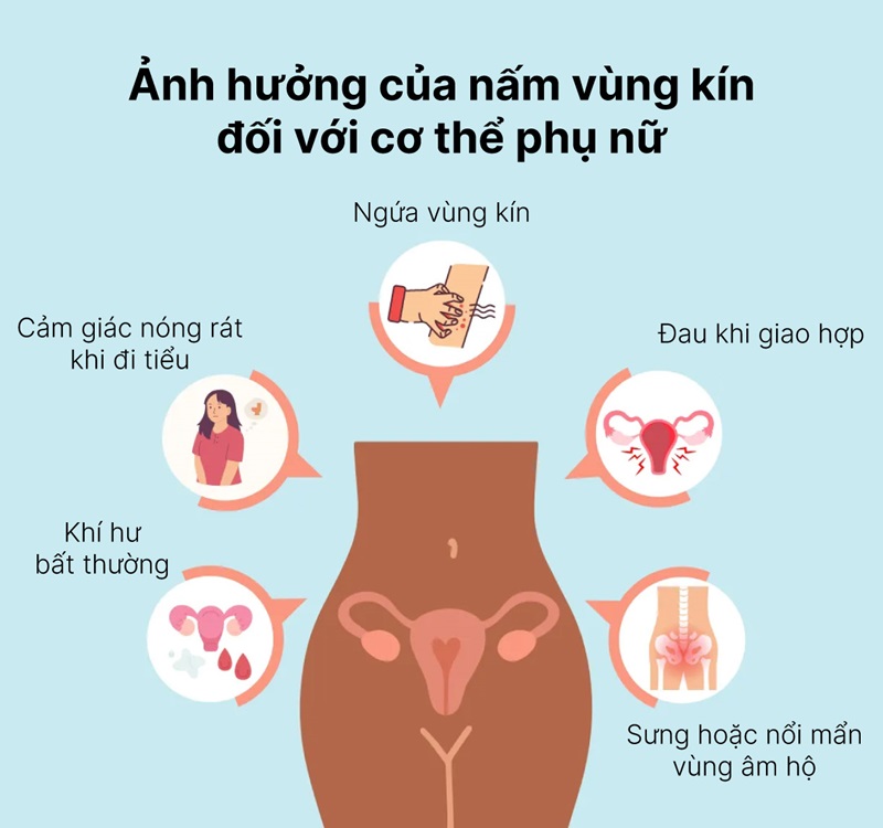 Triệu chứng và dấu hiệu nhận biết nấm vùng kín