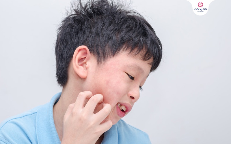 Quai bị chỉ xảy ra ở trẻ em?