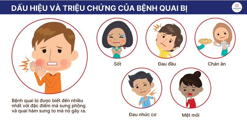 Triệu chứng nhận diện bệnh quai bị