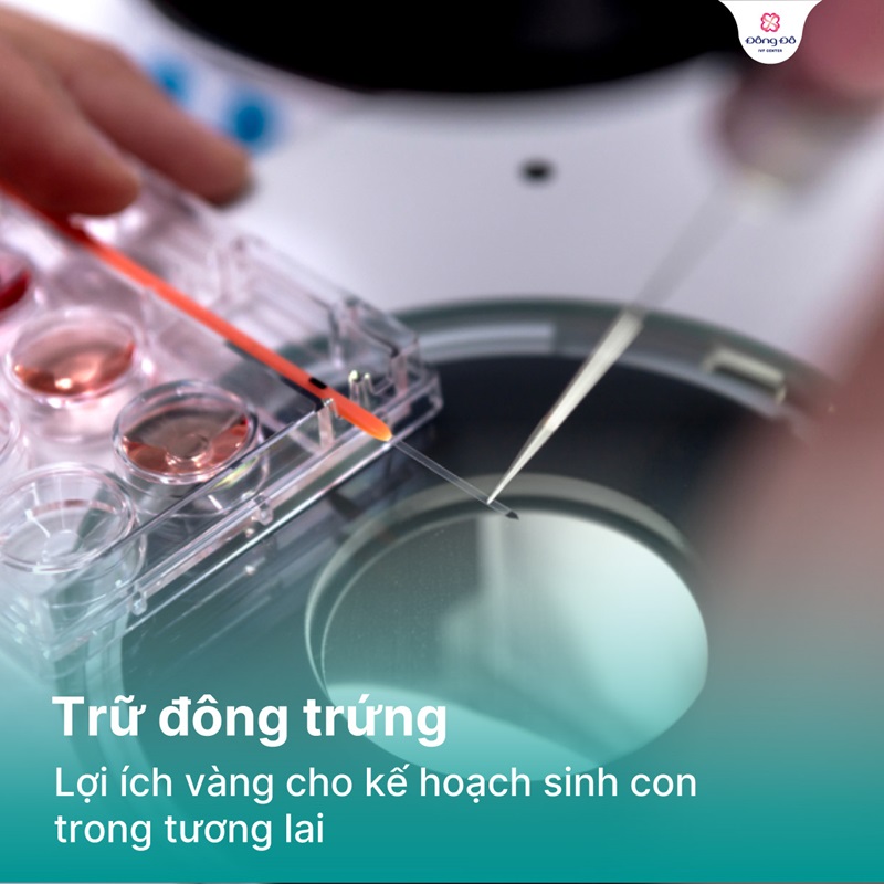 Trữ đông trứng