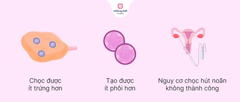 Nhược điểm chính của Mini IVF và ảnh hưởng đến khả năng thành công