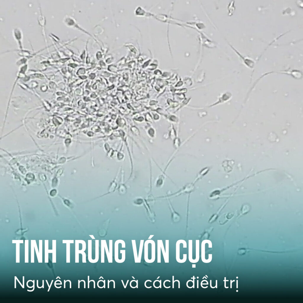 tinh trung von cuc bac si tang duc cuong