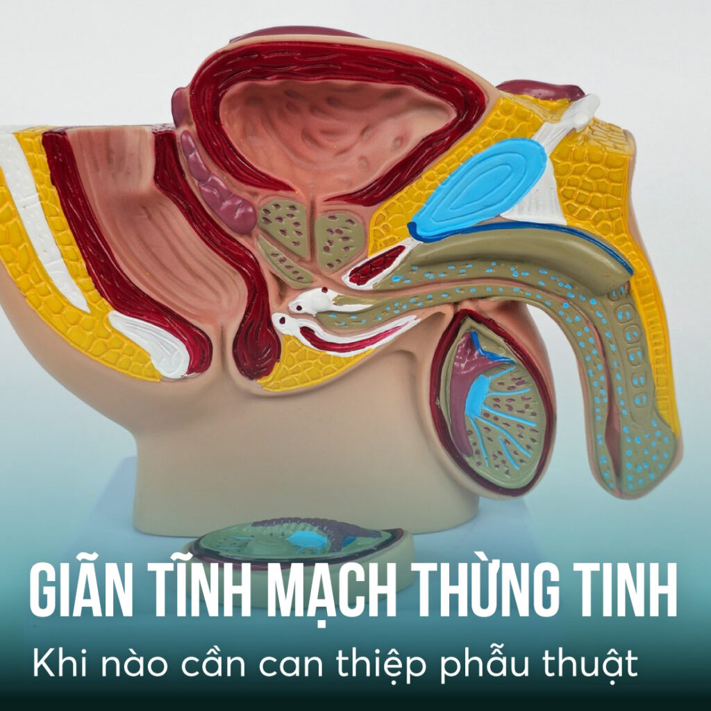 gian tinh mach thung tinh bac si tang duc cuong