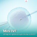 Mini IVF và PGT