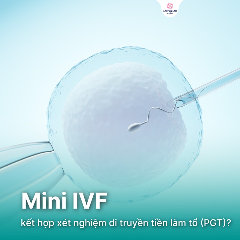 Mini IVF và PGT
