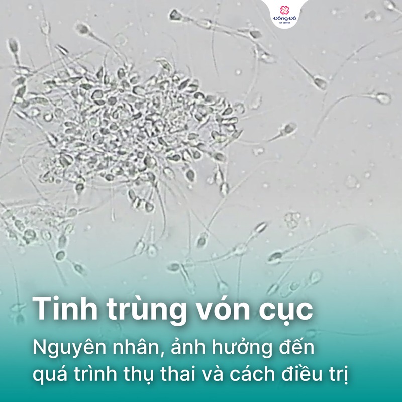 Tinh trùng vón cục