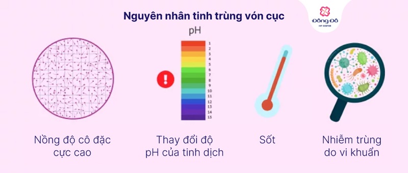 Nguyên nhân dẫn đến tinh trùng vón cục