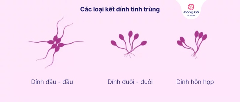 Ảnh hưởng của tinh trùng vón cục tới khả năng thụ thai