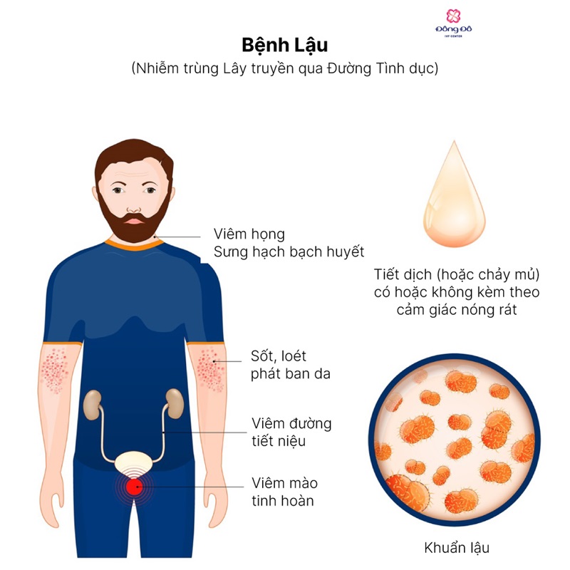 Triệu chứng bệnh lậu ở nam giới