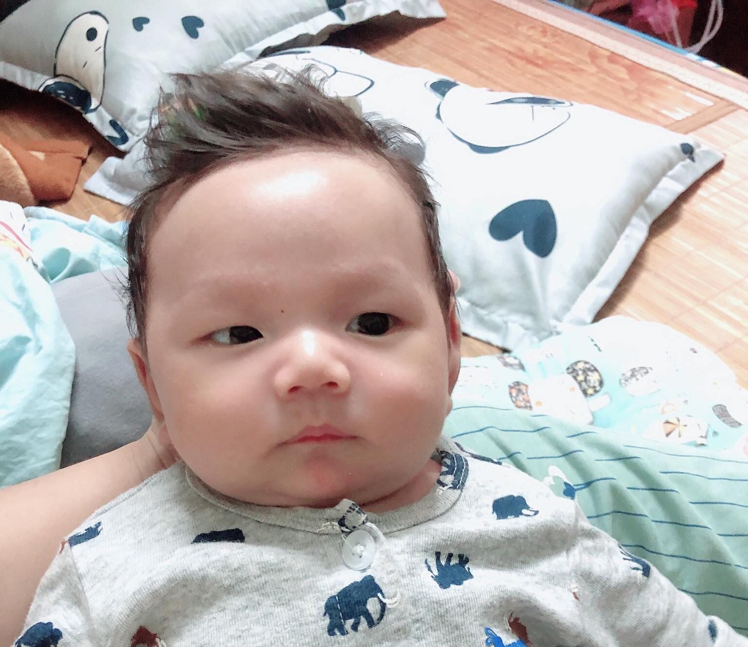 Vô sinh không rõ nguyên nhân 4 năm, đón thành công song thai IVF