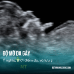 Độ mờ da gáy là gì