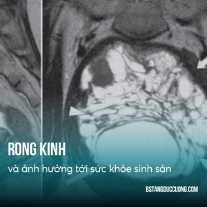 rong kinh