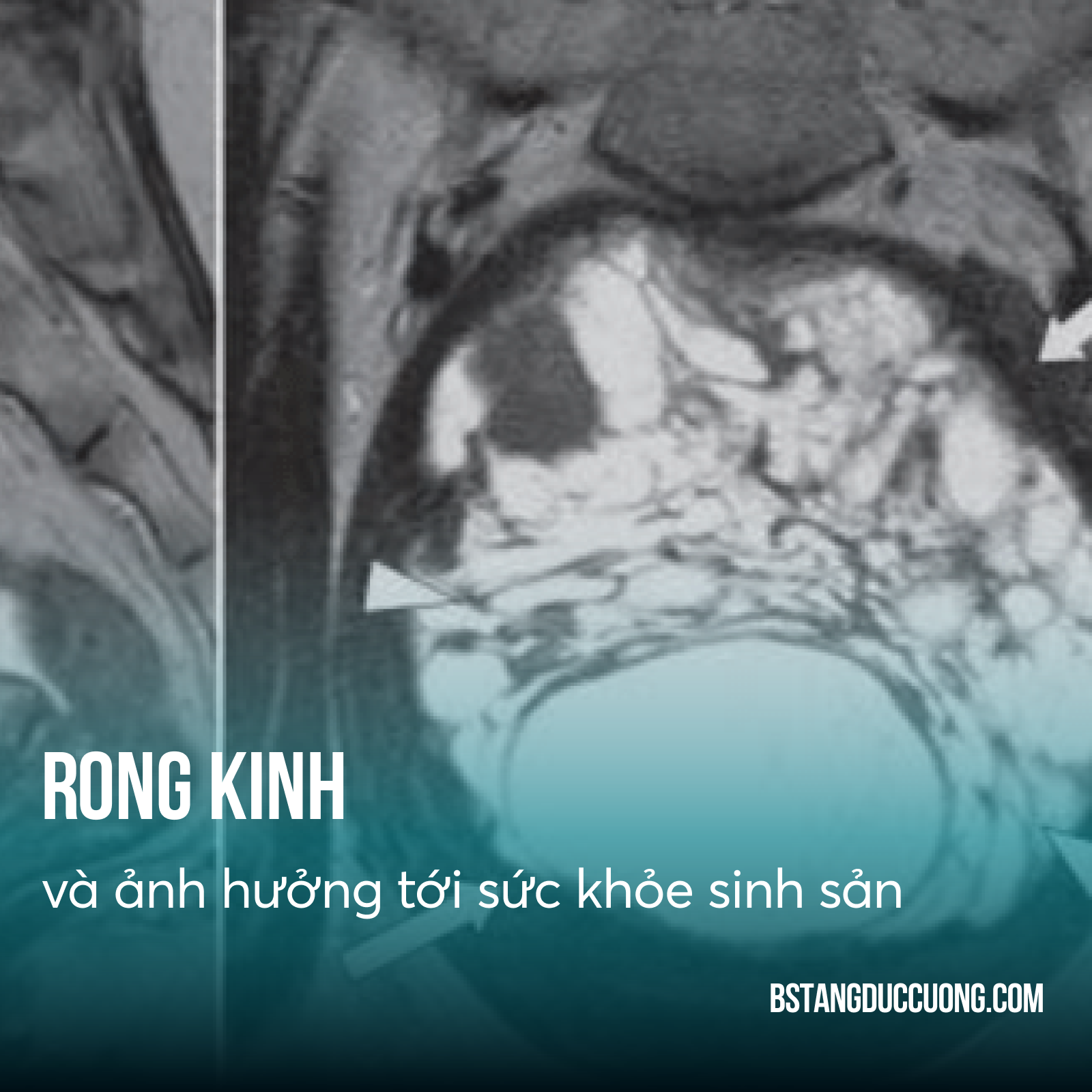 rong kinh